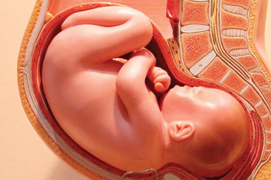  تشخیص جنسیت جنین از روی عوارض حاملگی