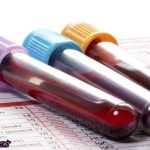 طریقه ی خواندن آزمایش خون بارداری