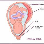 در بارداری طول سرویکس چقدر باید باشد؟