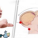 هرگز نوزاد خود را شدید تکان ندهید!