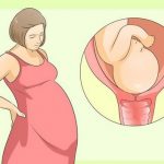 زایمان طبیعی چه فوایدی برای مادر و نوزاد دارد؟