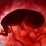 بررسی خطرات بارداری و سقط جنین جهت زنان مبتلا به ام اس