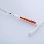 روش پیشگیری آی یو دی چیست؟/ انواع آی یو دی